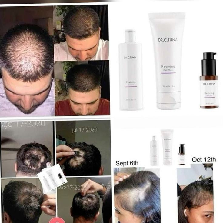 Set Reviving Anticaída de cabello