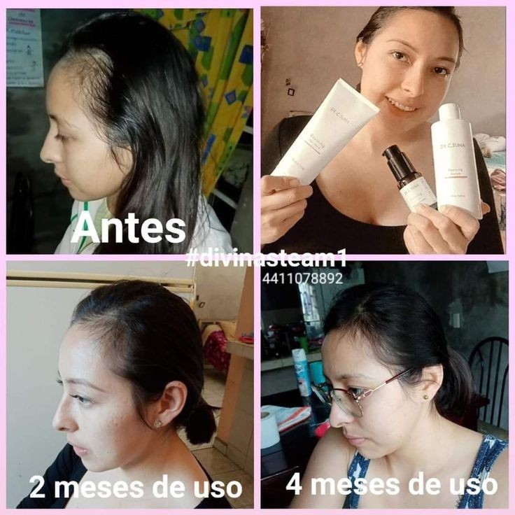 Set Reviving Anticaída de cabello